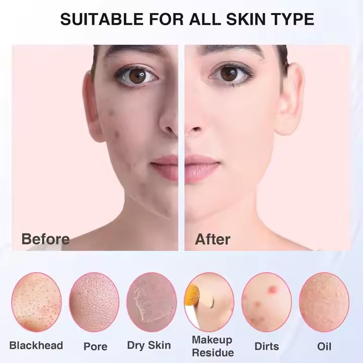Sonic Waterproof Facial Cleans - Electric Face Cleanser Brush ulasan dan harga