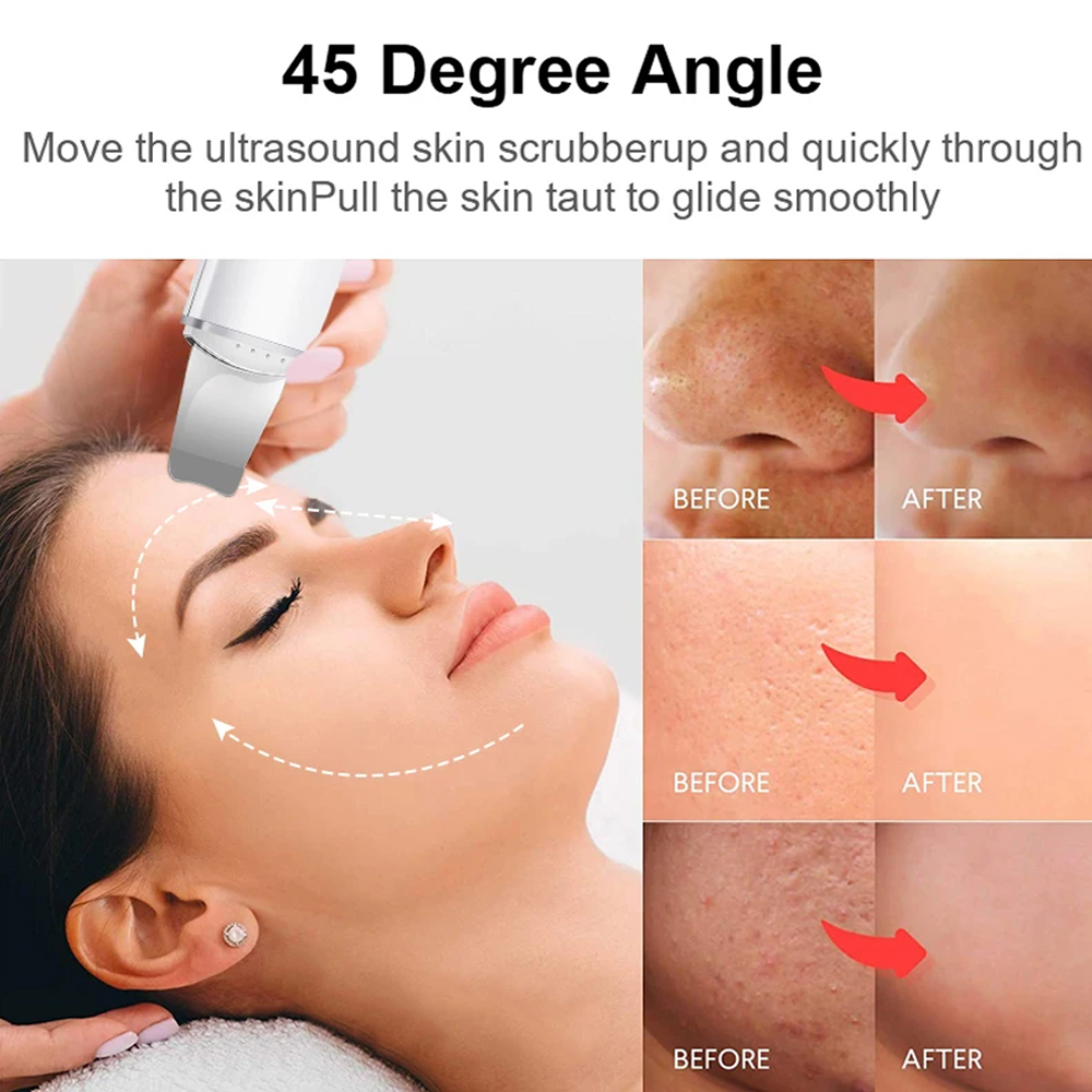 Electric Skin Scrubber Peeling - Electric Face Cleanser Brush ulasan dan harga